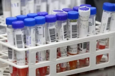Alagoinhas registra 11 novos casos de Covid-19 nas últimas 24h