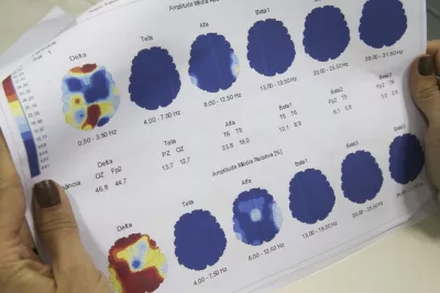 Março Roxo quer conscientizar população sobre a epilepsia