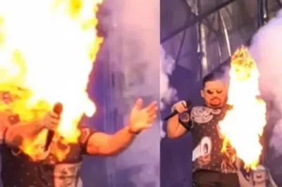 Xand Avião tem rosto atingido por fogo durante show em SP, mas passa bem