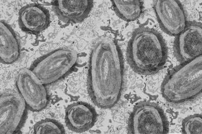 Brasil tem mais de 200 casos confirmados de varíola dos macacos