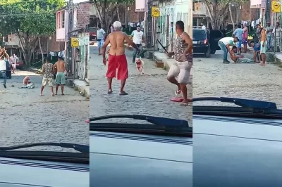 Gandu: Homem sofre ataque de cão pitbull no meio de rua