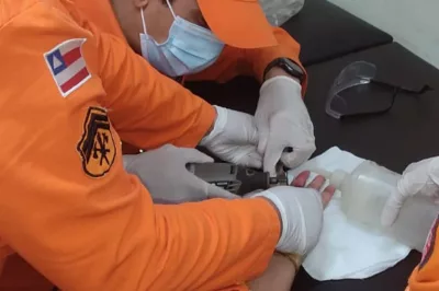 Bombeiros são acionados para retirar anel de dedo de paciente