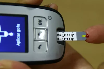 Médico alerta para o risco de pé diabético em pacientes