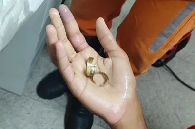 Anel é retirado do dedo de adolescente por bombeiros de Camaçari