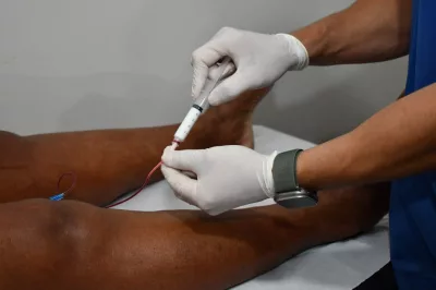 Programa de Redução de Filas: Cirurgia de varizes continuam acontecendo em Alagoinhas