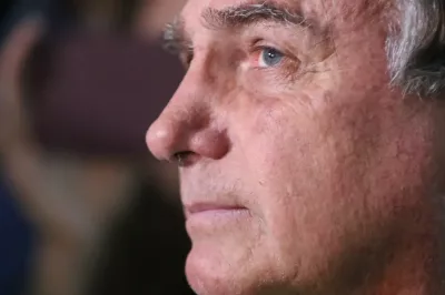 Após pedido de cirurgia, Moraes manda PF fazer perícia em Bolsonaro