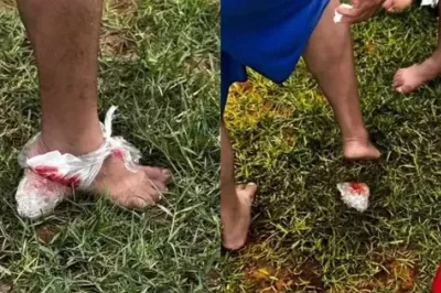 Ataque de piranhas deixa feridos em Iaçu e prefeitura deve interditar trecho do Rio Paraguaçu