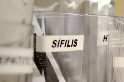 SUS passa a adotar antibiótico para prevenir sífilis e clamídia