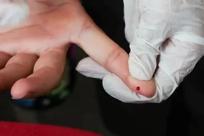Julho Amarelo: Alagoinhas mobiliza saúde pública contra as hepatites virais e realiza “Dia D” de testagem rápida